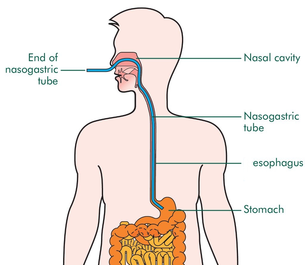 Have You Ever Tried To Force Feed A Captured Human The Atlantic Have You Ever Tried To Force Feed A Captured Human The Atlantic